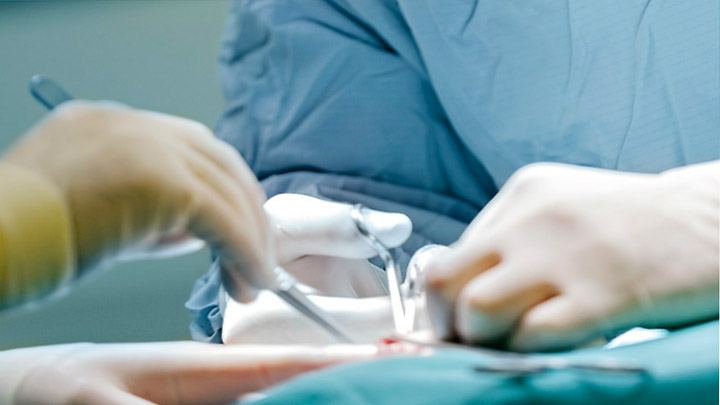 बहन की संपत्ति हड़पने के लिए लिंग परिवर्तन कराकर लड़की बन गया युवक...