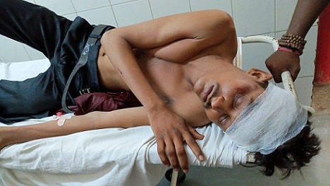 Bareilly News : सड़क किनारे खड़े आईटीआई के छात्र को तेज रफ्तार वाहन ने मारी टक्कर