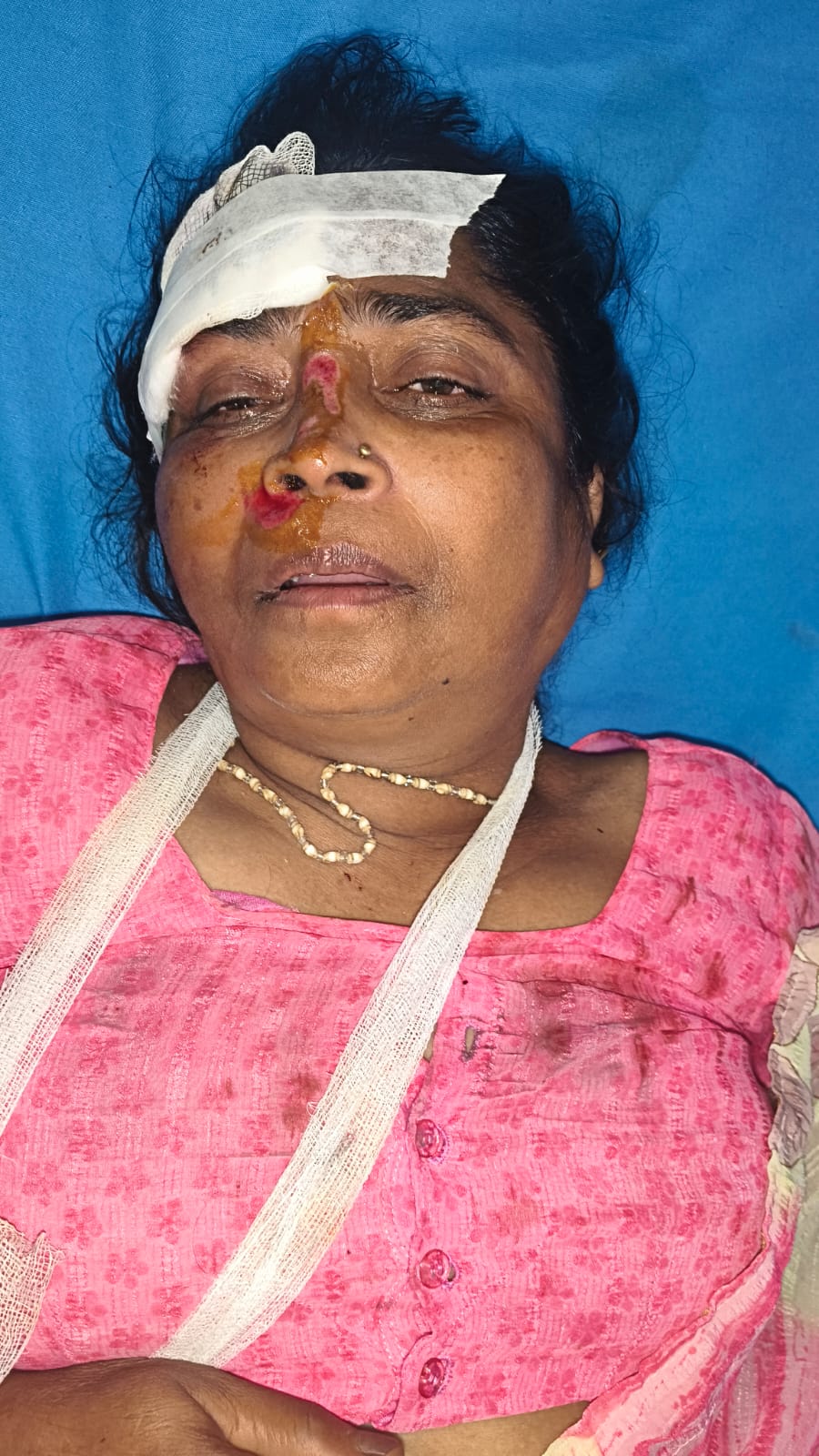 Bareilly News: महिला से कुंडल छिनैती मामले में मुकदमा दर्ज, बदमाशों की तलाश जारी