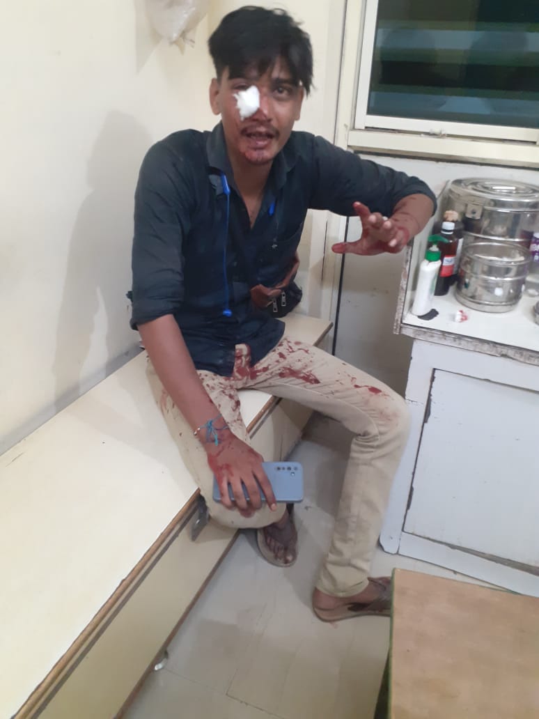 Bareilly News: बरेली में दरोगा की दबंगई: डिलीवरी ब्वॉय पर बरसा डंडा, सड़क पर गिरा घायल युवक