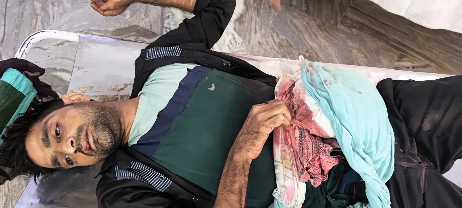 Bareilly News: युवक ने उधार के रुपये मांगे तो दबंगों ने किया चाकू से हमला 