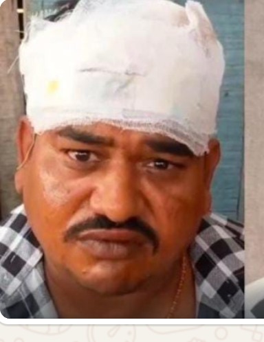 Bareilly News: सीबीगंज में नदोसी गांव में लाठी-डंडे चले, दो घायल 