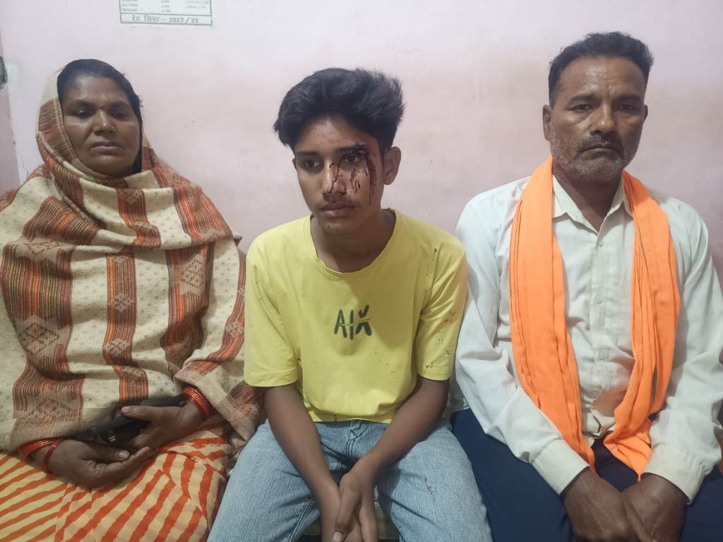Bareilly News : नाबालिग छात्र पर जान लेवा हमला, जाति सूचक गालियों के साथ की गई मारपीट