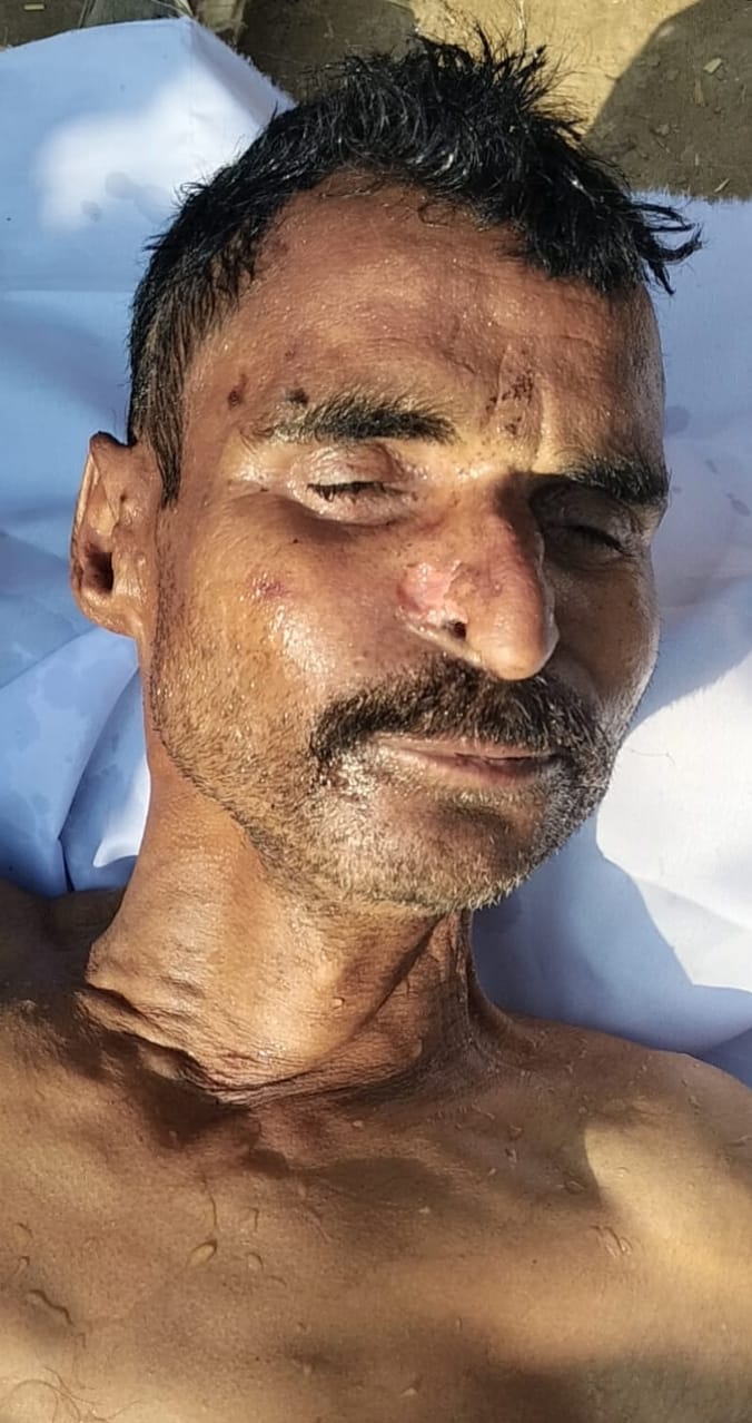 KASGANJ NEWS सोरों क्षेत्र में 55 वर्षीय अधेड़ की संदिग्ध परिस्थितियों में मौत, पुलिस ने शुरू की जांच